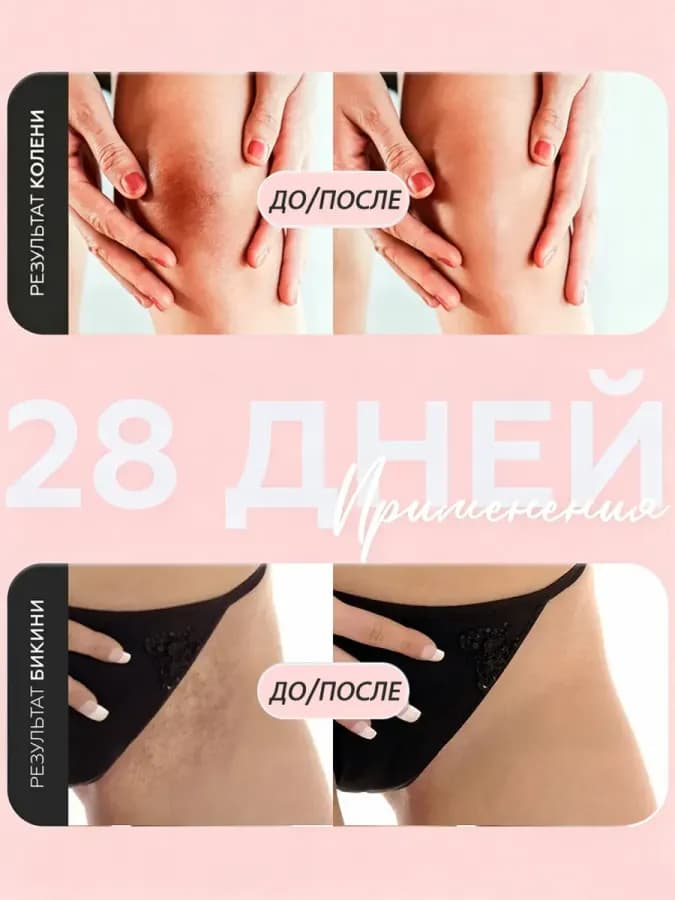 MR&MISS Отбеливающий крем для интимной зоны, тела, ягодиц — фото 3